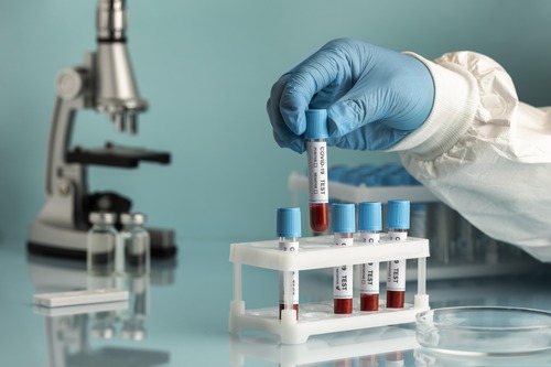 Samples of blood from a patient are in vials as a Unit Clerk handless them for testing